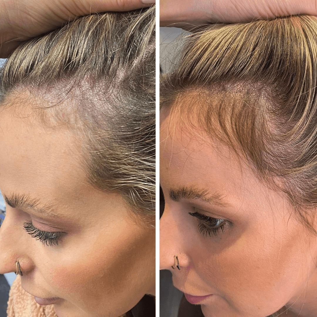 Real customer hair growth results