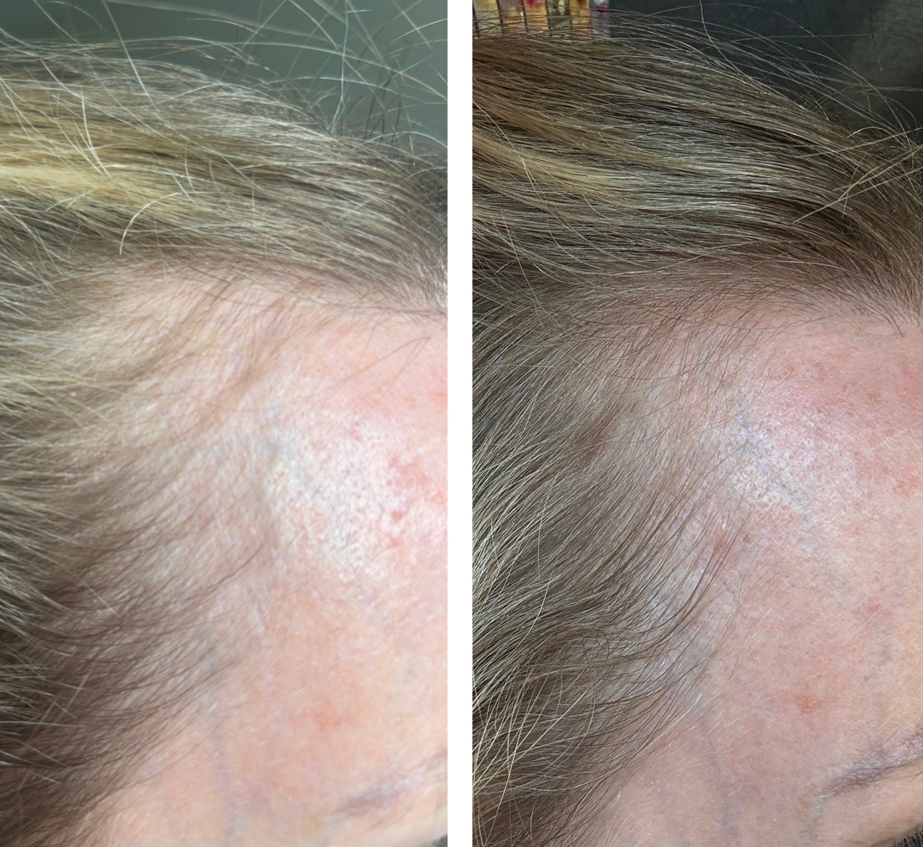 Trudermal 